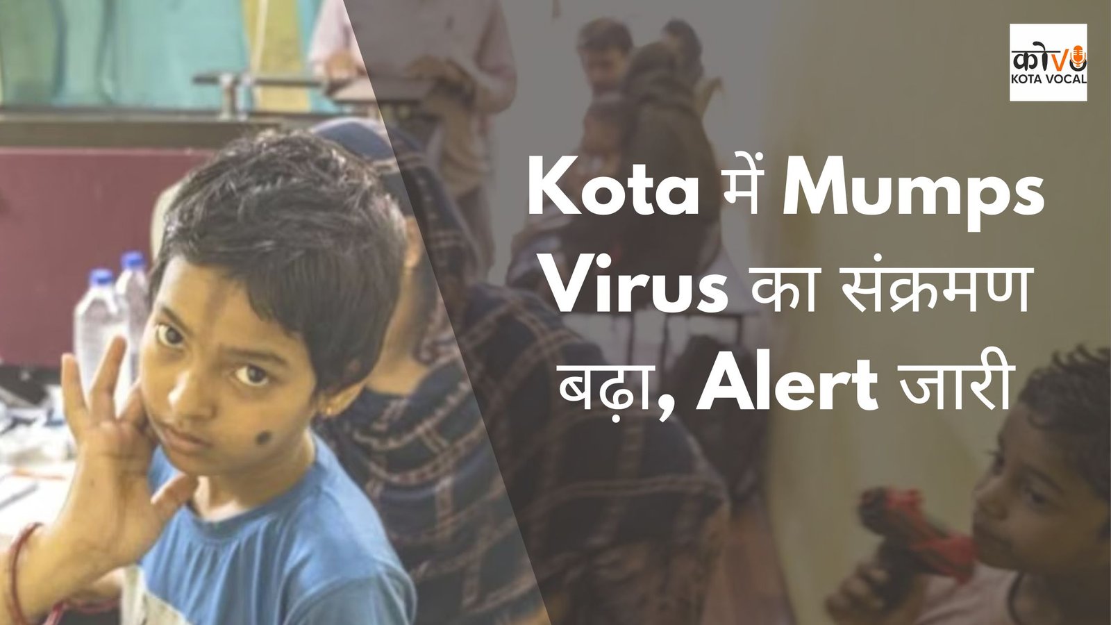 Kota में Mumps Virus